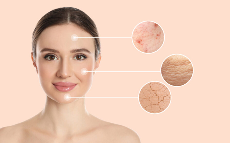 cách chăm sóc da đúng cách