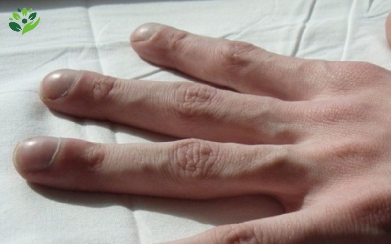 biểu hiện bệnh lý