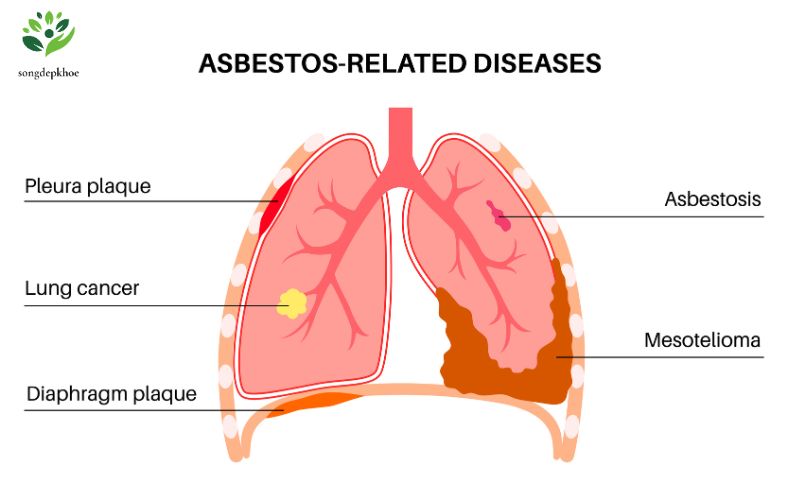 bệnh mãn tính phổ biến