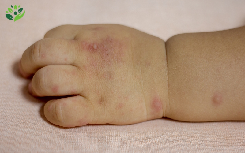 bệnh thường gặp ở trẻ em