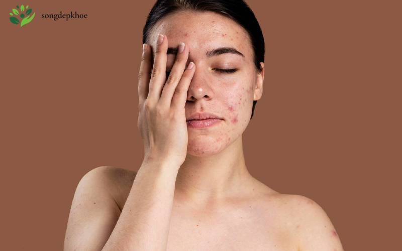 các bước chăm sóc da